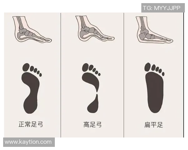 扁平足球员的挑战与成功：探索足球界的扁平足明星人物